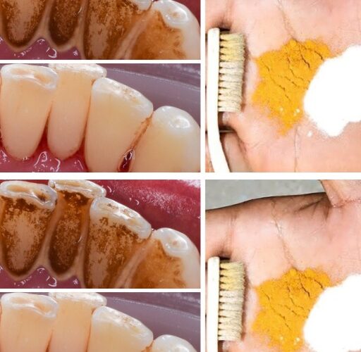 Trick to have whiter teeth, what do you think of this method?