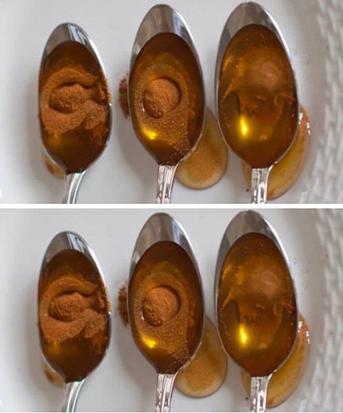 Honey and Cinnamon – A Blend that Cures 15 Diseases