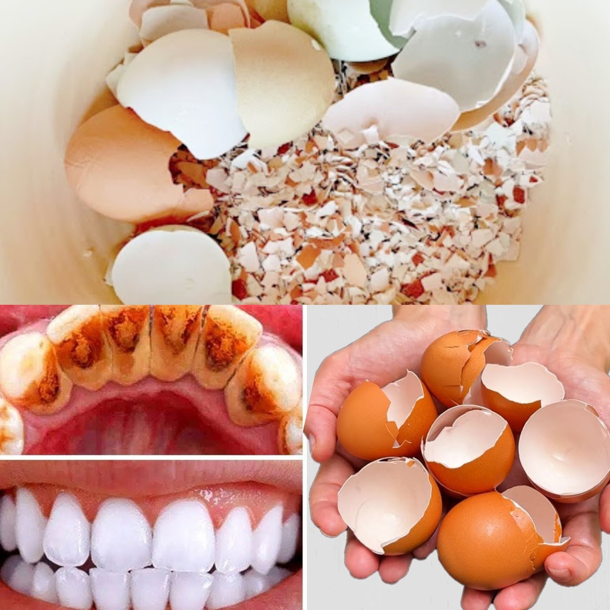 egg shell teeth whitening