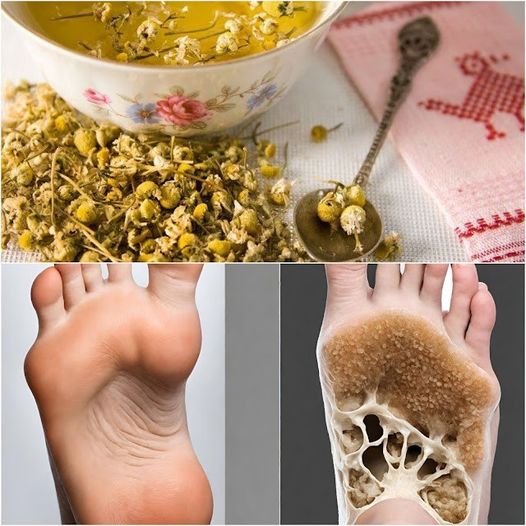 Apply chamomile on your feet and relax