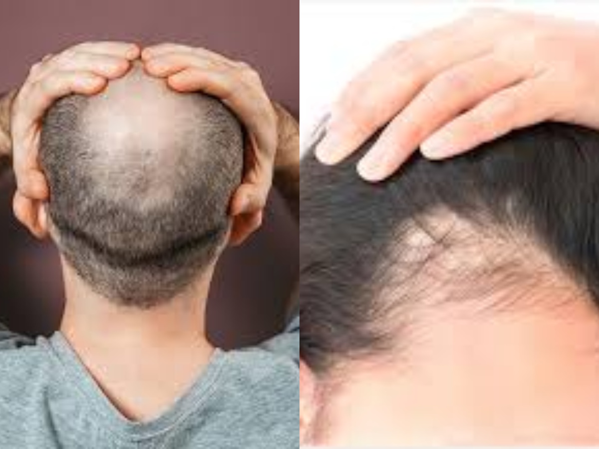 how to cure hair loss recipe
