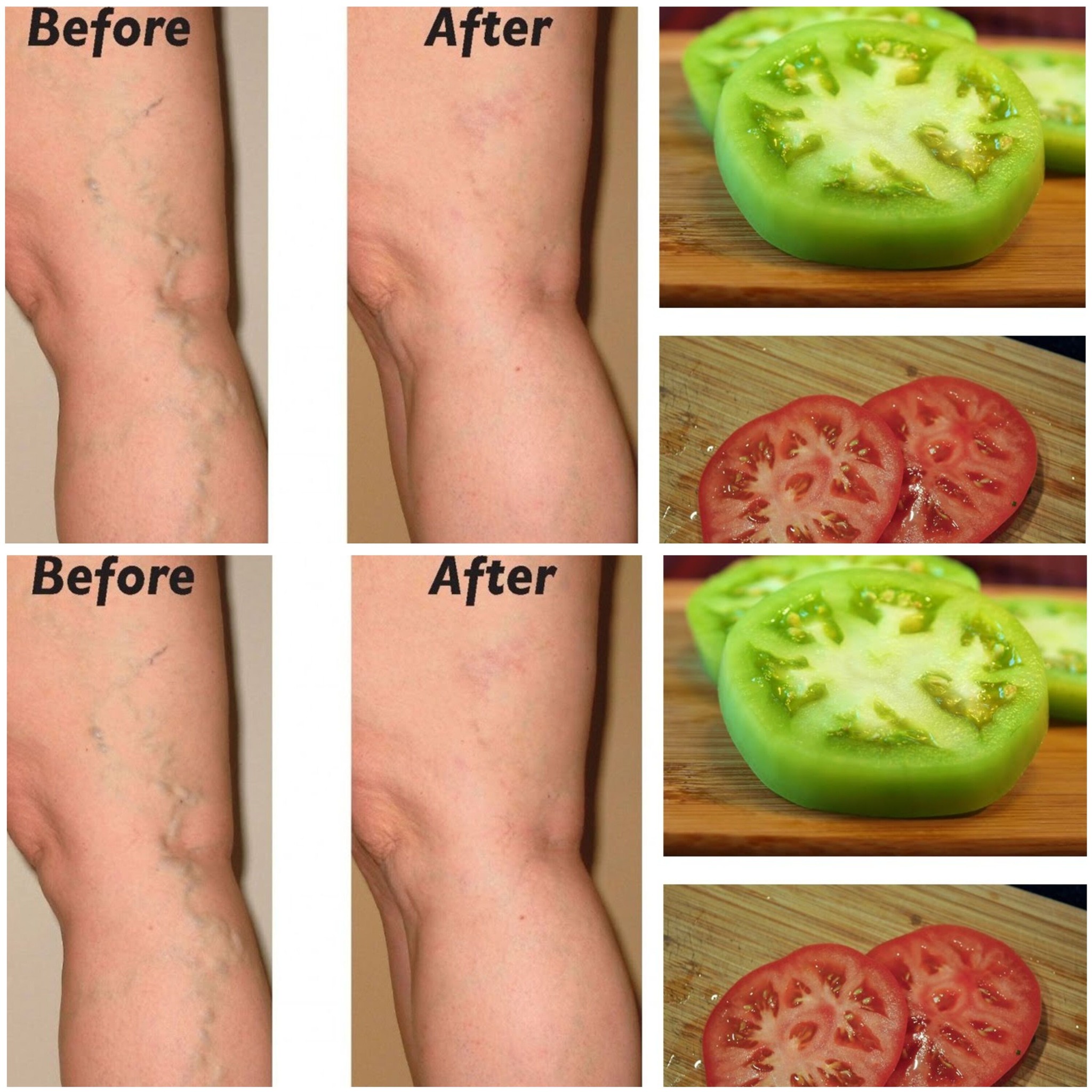 Holistic Solutions for Soothing Varicose Veins