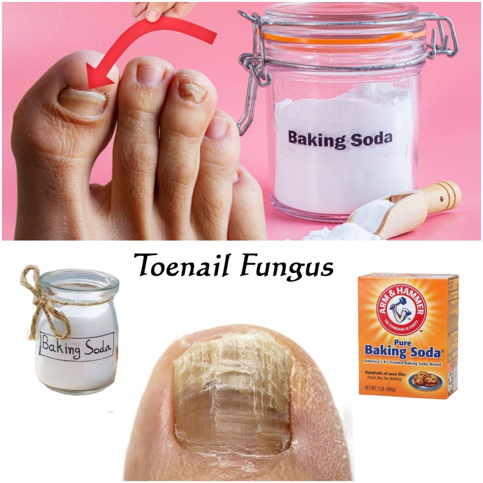 Say Goodbye to Toenail Fungus with This Natural Remedy - Yummy Recipes